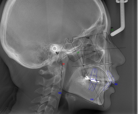 歯科用CT（KaVo 3D eXam +）